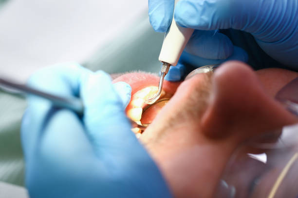 Best Same-Day Emergency Dental Services in Wadesboro, NC