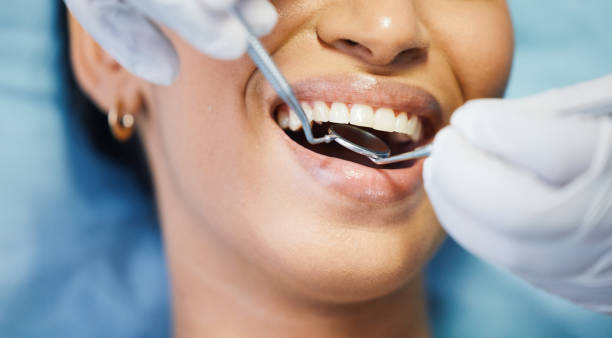 Best Emergency Treatment for Dental Infections or Abscesses in Wadesboro, NC